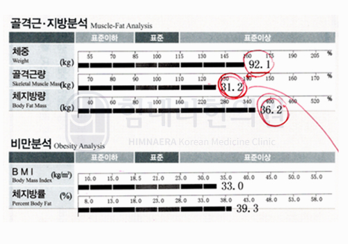 Before 이미지