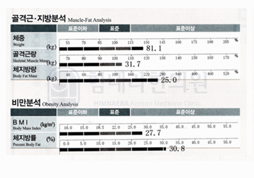 Before 이미지