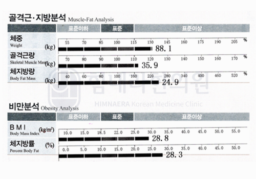 After 이미지