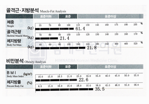After 이미지
