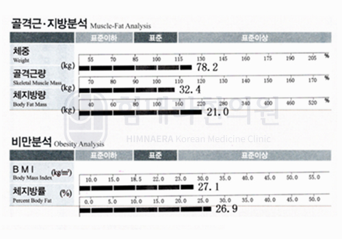 After 이미지