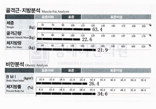 Before 이미지