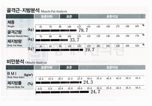 After 이미지