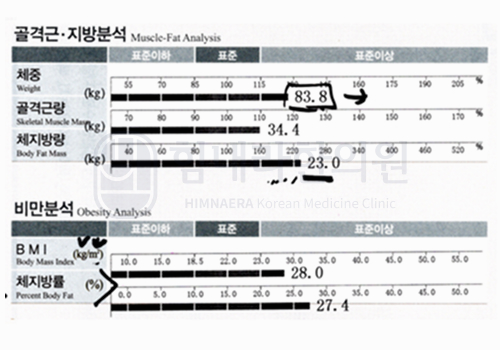 After 이미지