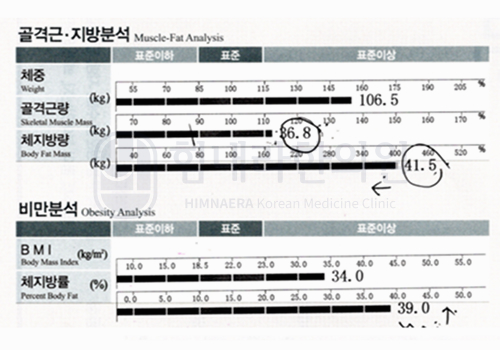 Before 이미지