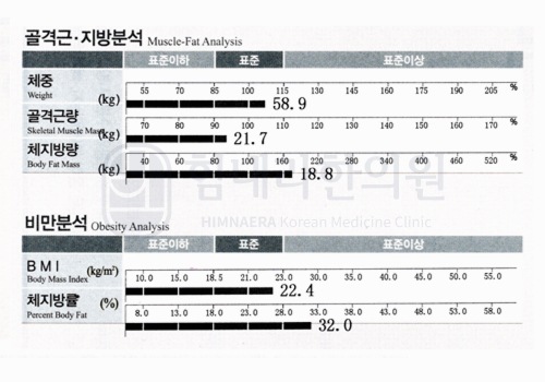 After 이미지