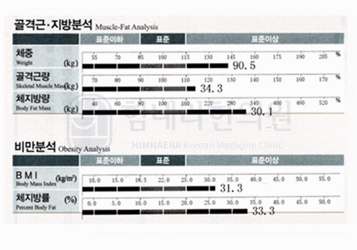 Before 이미지