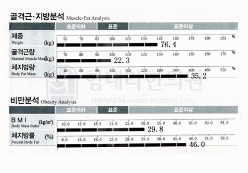 Before 이미지