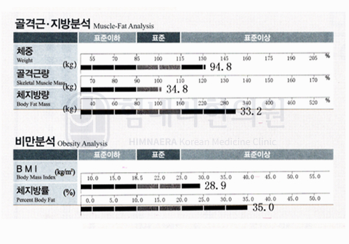 Before 이미지