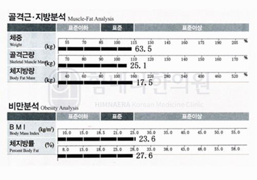 Before 이미지