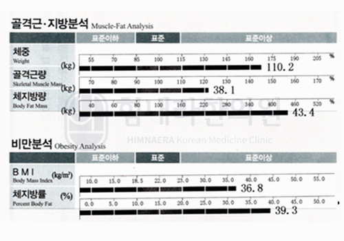 Before 이미지