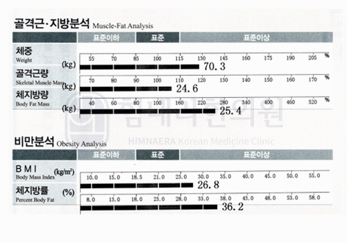 Before 이미지