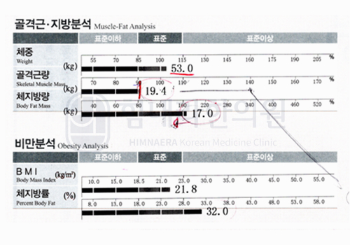 Before 이미지