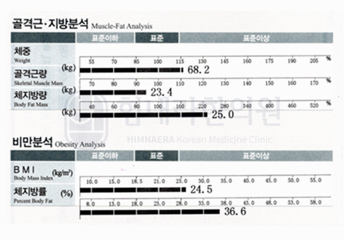 Before 이미지