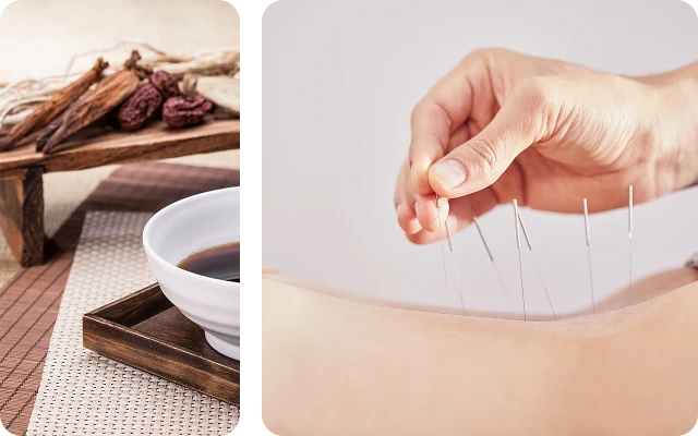 치료 진행